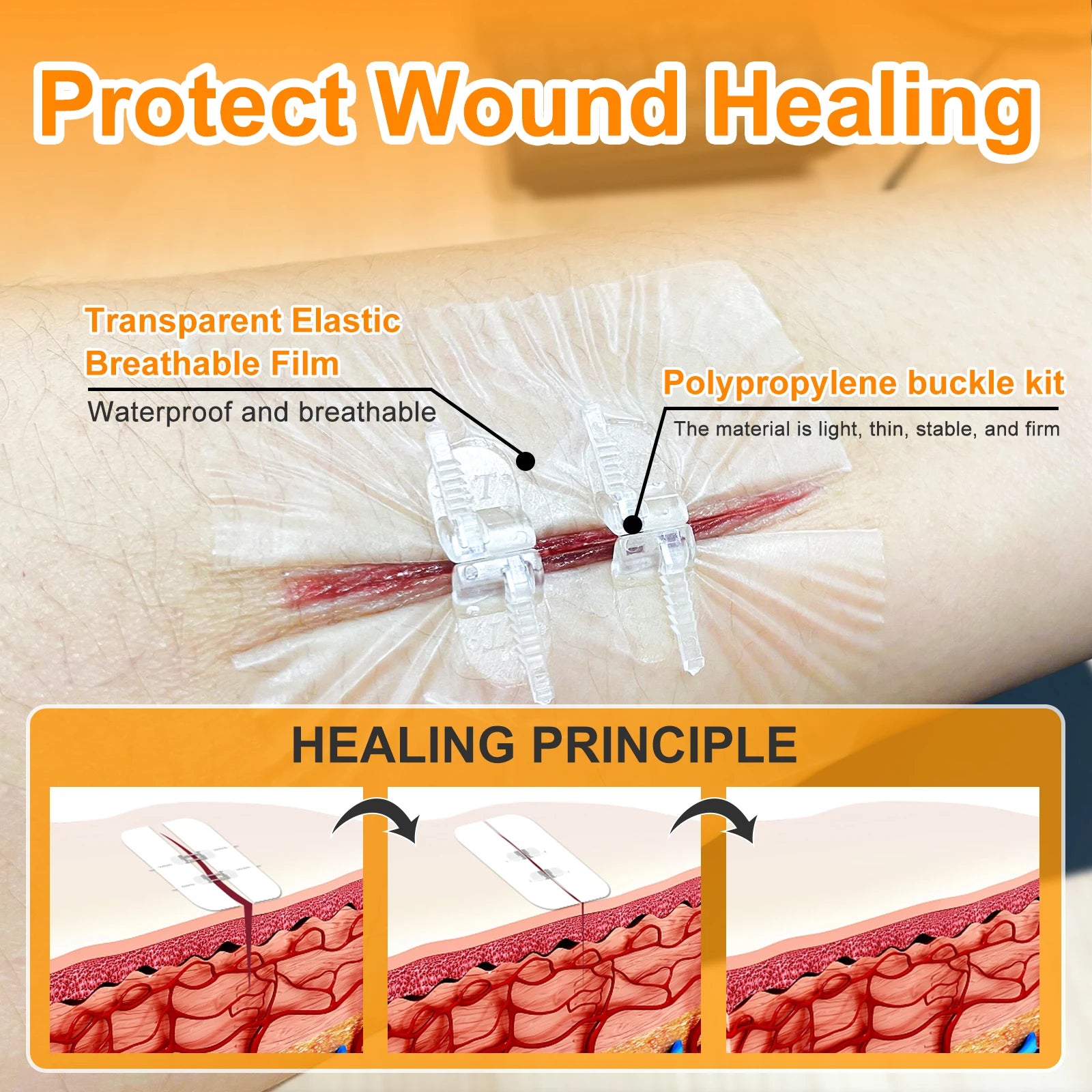 CARBOU 2PCS Zipper Painless Wound Closure Device Suture-Free Wound Dressing Closure Strips Kit Emergency Laceration Closures